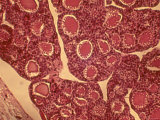 Human Thyroid X400