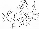 Human Chromosomes