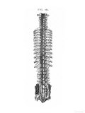 Vertebral Sinuses Spinal Canal