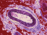Healthy Artery Cross-Section