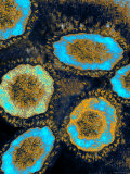 Sars Coronavirus Composite Severe Acute Respiratory