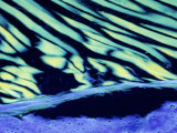 Micrograph Fibrous Cartilage X20 Fibers