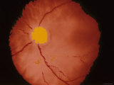 Ophthalmic Image of Retina Normal