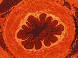 Transitional Epithelium Ureter Distention