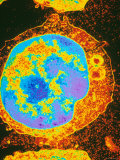 Lymphocyte from Peripheral Blood Tem X10 000 Enhanced