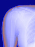 X Ray Shoulder Outline of Skin Visible