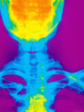 Enhanced X-Ray Normal Cervical Spine  Apex Lung