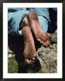 Close up of a pilgrims feet after walking the Stations of the Cross on Lough Derg