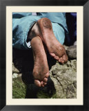 Close up of a pilgrims feet after walking the Stations of the Cross on Lough Derg