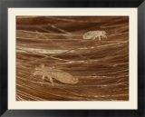 Head lice crawling through hair