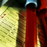 Medical Checklist Along with Vials of Blood