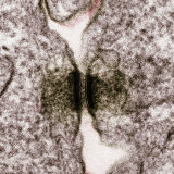 Desmosome Cell Junction Between Human Skin Cells