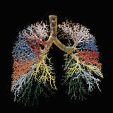 Resin Cast of Lungs  Bronchial Tree