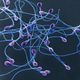 Human Sperm or Spermatozoa  Showing the Heads  Midpieces  and Long Flagella - Sem