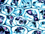 Parenchyma Cells in Potato with Starch Stained Purple