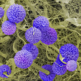 Aspergillus Niger Mold Fruiting Bodies (Conidiophores or Sporangia) and Hyphae