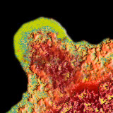 Hiv Budding