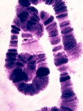 Polytene Chromosomes from an Insect
