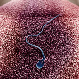 Human Sperm Fertilizing an Egg