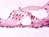 Organ of Corti in the Ear