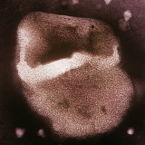 Close-Up of a Liposome