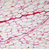 Adipose Tissue in the Hypodermis of Human Skin