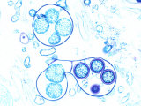 Water Mold  Saprolegnia  Showing a Sperm Tube