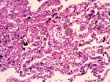 bacillus anthracis pasteur