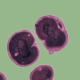 Tem of Neisseria Gonorrhoeae  the Bacterium That Causes Gonorrhea Tem X160  000 at 4X5