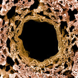 A Bronchiole and Numerous Alveoli in the Lung