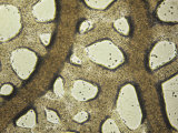 Slime Mold  Physarum Polycephalum  Plasmodium Retreating