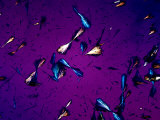 Tyrosine Crystals in Urine  Unstained  Polarized View