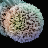 Aspergillus Niger Mold Sporangium and Spores