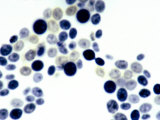 Budding Yeast (Saccharomyces Cerevisiae) Brightfield