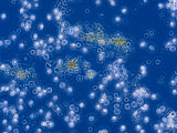 Urine with Bilirubin Crystals  Unstained  Phase Contrast View