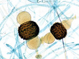 Bread Mold  Rhizopus Stolonifera  Zygotes