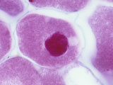 Nitrogen-Fixing Bacteria (Rhizobium Leguminosarum) in Legume Root Cells