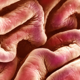 Folds of the Human Bladder Epithelium