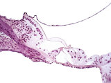Organ of Corti in the Human Cochlea
