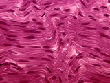 White Fibrous Tissue of a Tendon  the Connective Tissue That Connects Muscles to Bones