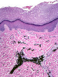 Cross-Section of Human Skin with Embedded Dye from a Tattoo