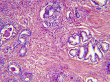 Histology of the Human Prostate Gland