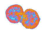 Neisseria Gonorrhoeae Bacteria That Causes the Sexually Transmitted Disease Gonorrhea