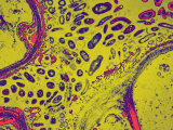 Nitrogen-Fixing Bacteria  Rhizobium  in Pea  Pisum  Root Cells