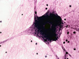 label and drawing of a multipolar neuron