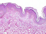Human Skin Section
