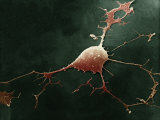 Human Neuron  Showing the Dendrites and the Axon