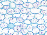 Buttercup  Ranunculus  Plant Root Cortex Parenchyma with Starch Grains
