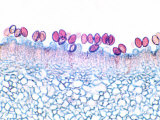 Basidiomycetes Fungi with Basidiospores on a Gill  Coprinus Comatus