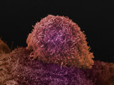 Prostate Cancer  Electron Microscopy Unit  Cancer Research  UK